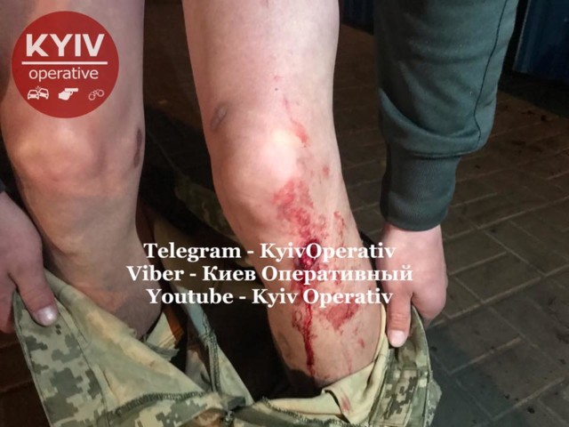 В Киеве драка закончилась стрельбой