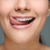 При недостатке витамина D3 чаще возникают воспалительные процессы между зубами и деснами
