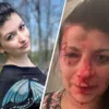 Наталья Эшонкулова до и после избиения. Коллаж "Сегодня"