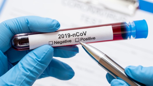В Бельгии разработали новые тесты на коронавирус: 100% точность