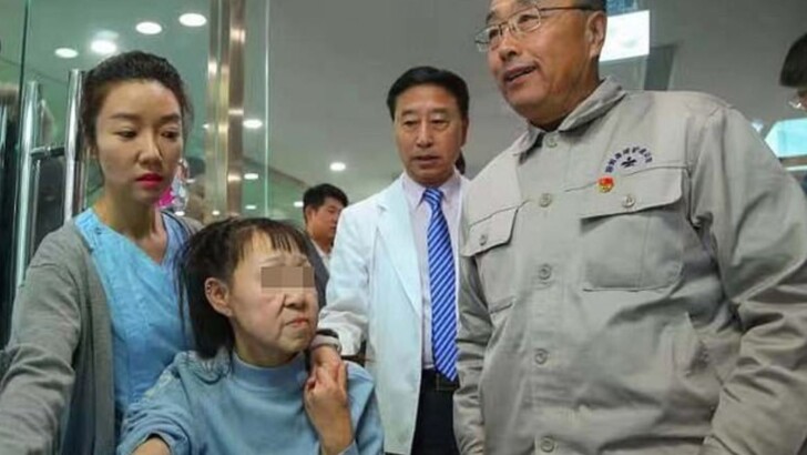 Сяо Фэн обзавелась новой внешностью | Фото: Shenyang Sunline Plastic Surgery Hospital