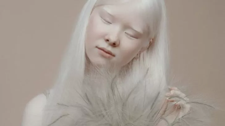 Девочка-альбинос из Казахстана