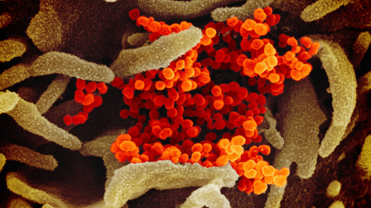 Коронавірус під мікроскопом. Фото: flickr.com/photos/niaid