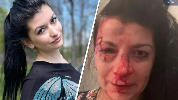 Наталья Эшонкулова до и после избиения. Коллаж "Сегодня"