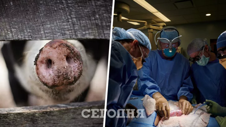 Вчені пересадили нирку свині людині