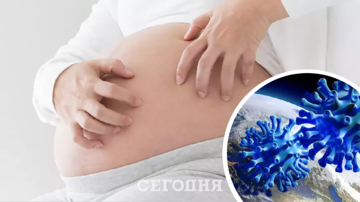 На Рівненщині знову померла вагітна дівчина від коронавірусу. Фото: колаж "Сьогодні"