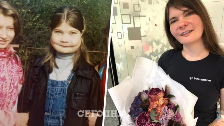 Ольга Мацик, которая и-за редкого заболевания потеряла зубы, теперь снова улыбается