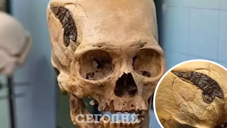 Археологи виявили сліди хірургії 2000-річної давності