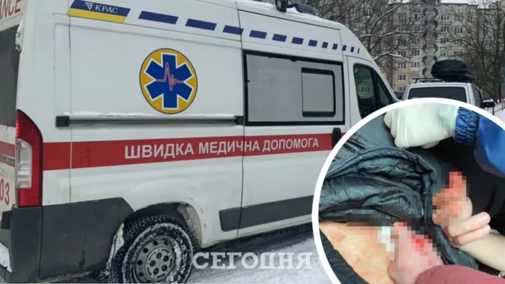 На Львівщині лікарі не могли допомогти пораненому чоловікові. Фото: колаж "Сьогодні"