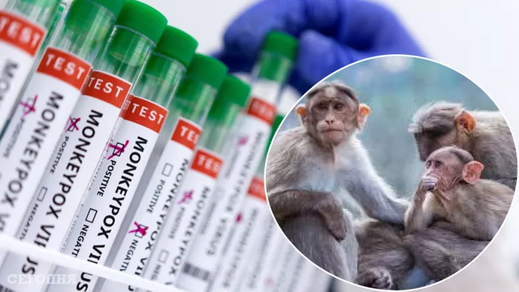 Вакцина від віспи мавп вже у розробці. Фото Reuters
