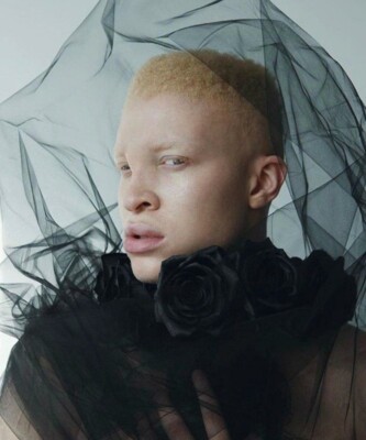 Американский модель-альбинос Шон Росс | Фото: instagram.com/shaundross