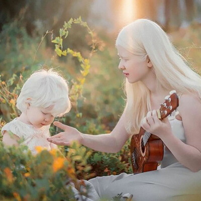 Сестры-альбиносы | Фото: Instagram.com/assel_kamila