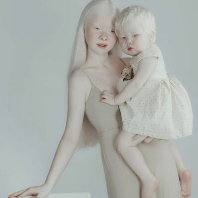 Сестры-альбиносы | Фото: Instagram.com/assel_kamila
