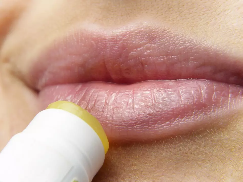 Прикладка губ – це процедура збільшення/відновлення та одночасного зволоження губ 