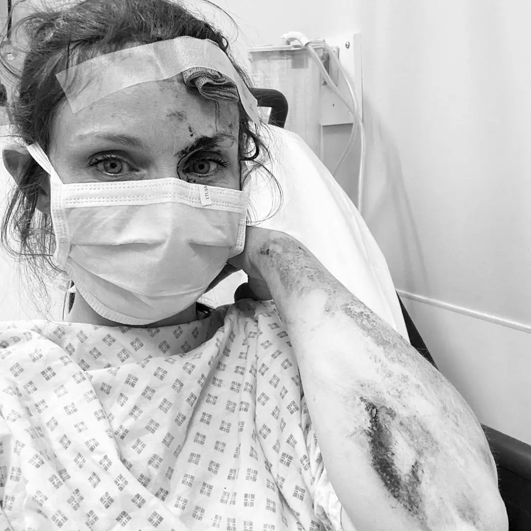 Певица Софи Эллис-Бекстор в больнице