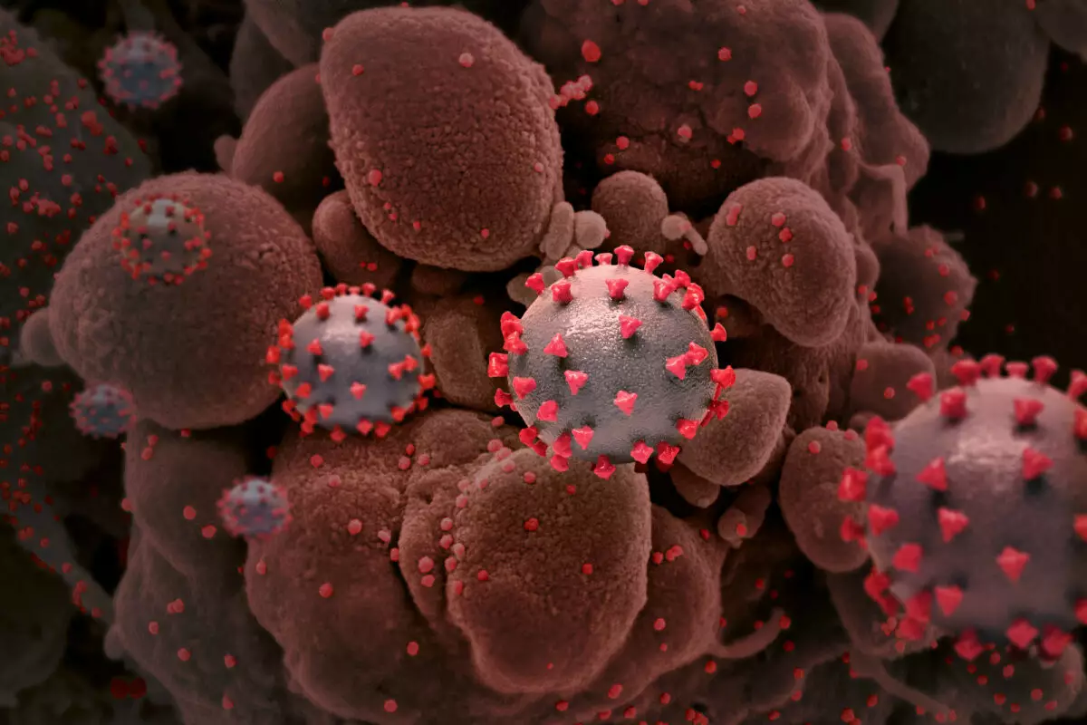 В "Дельта плюс" произошла мутация в спай-белке, который отвечает за проникновение клетки организма. Фото: National Institute of Allergy and Infectious Diseases, NIH