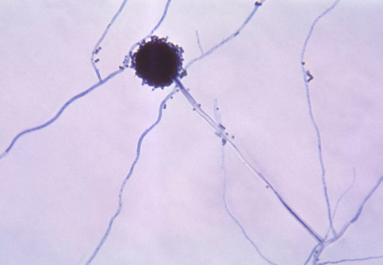 Так выглядит черный грибок аспергил. Фото: CDC/Dr. Lucille K. Georg
