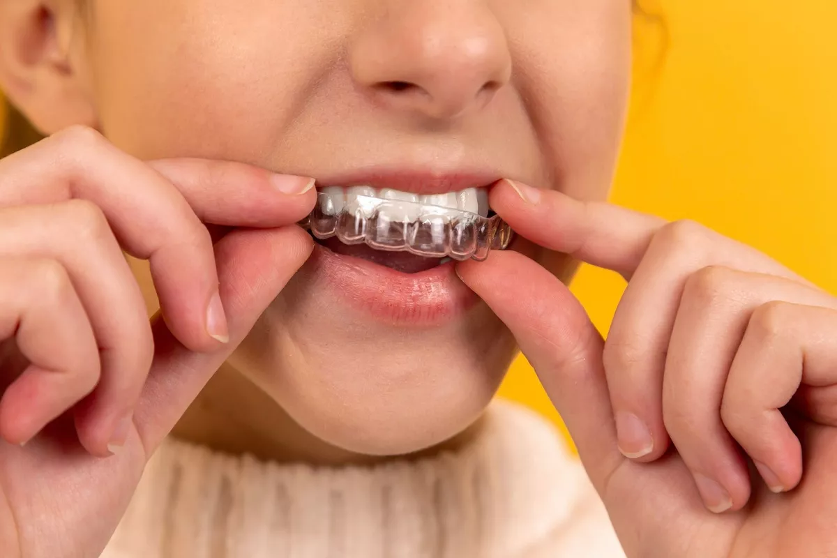 5 способов отбелить зубы в домашних условиях. Мнение стоматолога