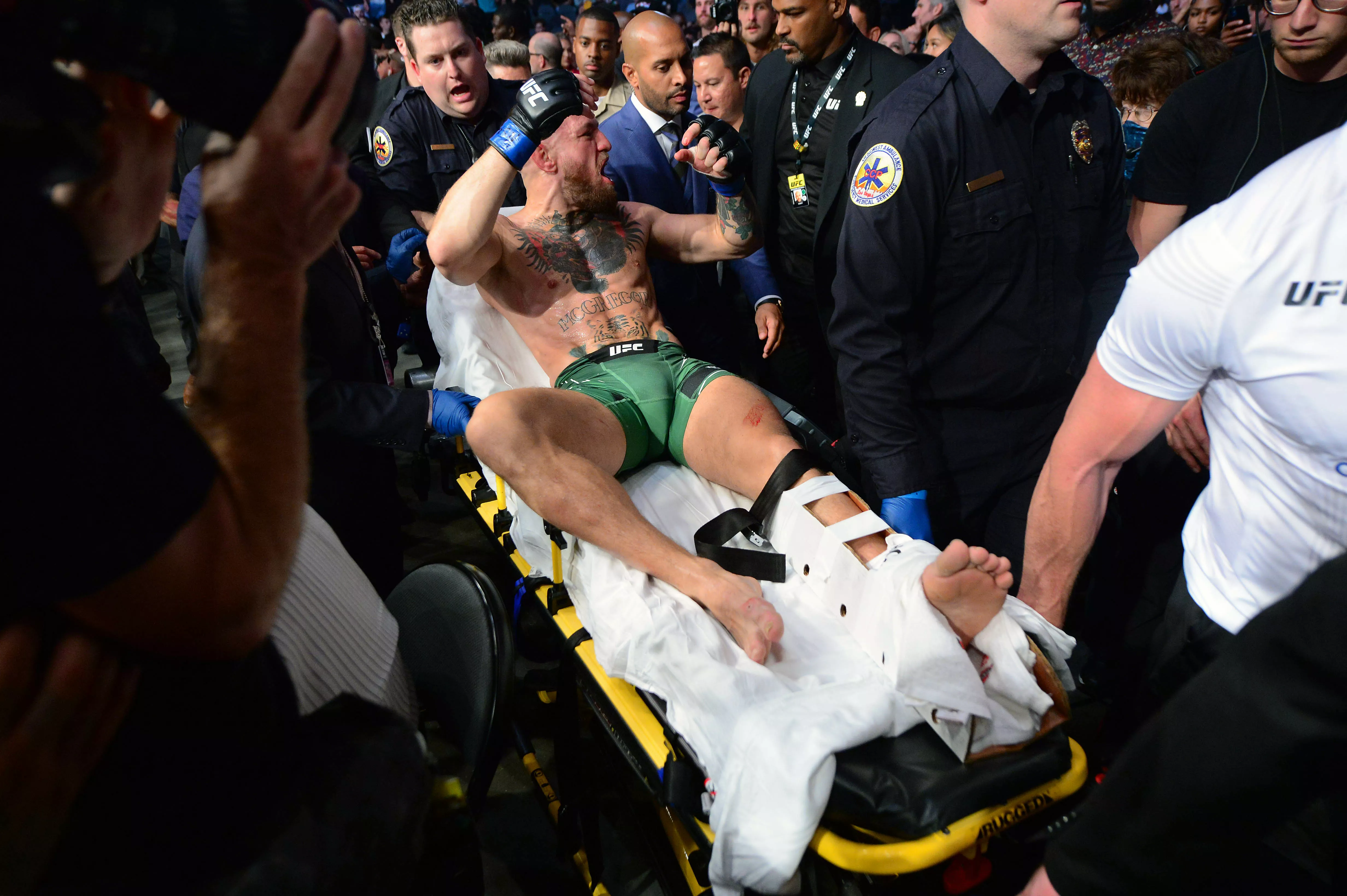 Конор Макгрегор сломал ногу в бою UFC