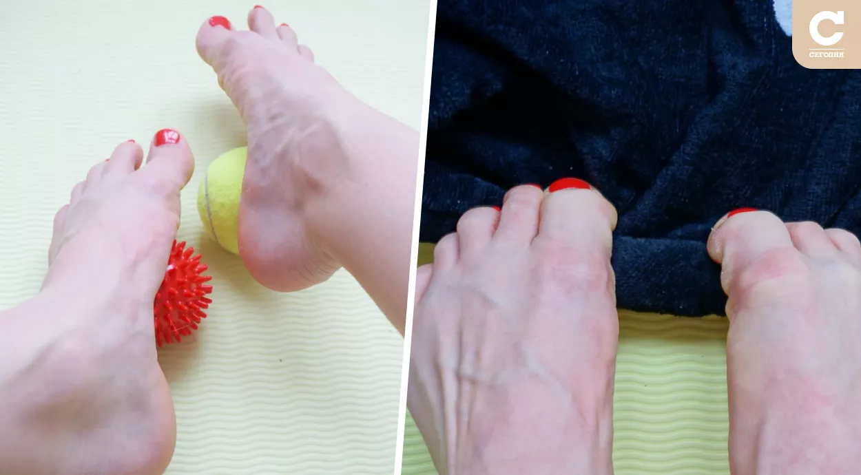Для профилактики варикоза поднимайте пальцами ног разные предметы, делайте самомассаж стоп