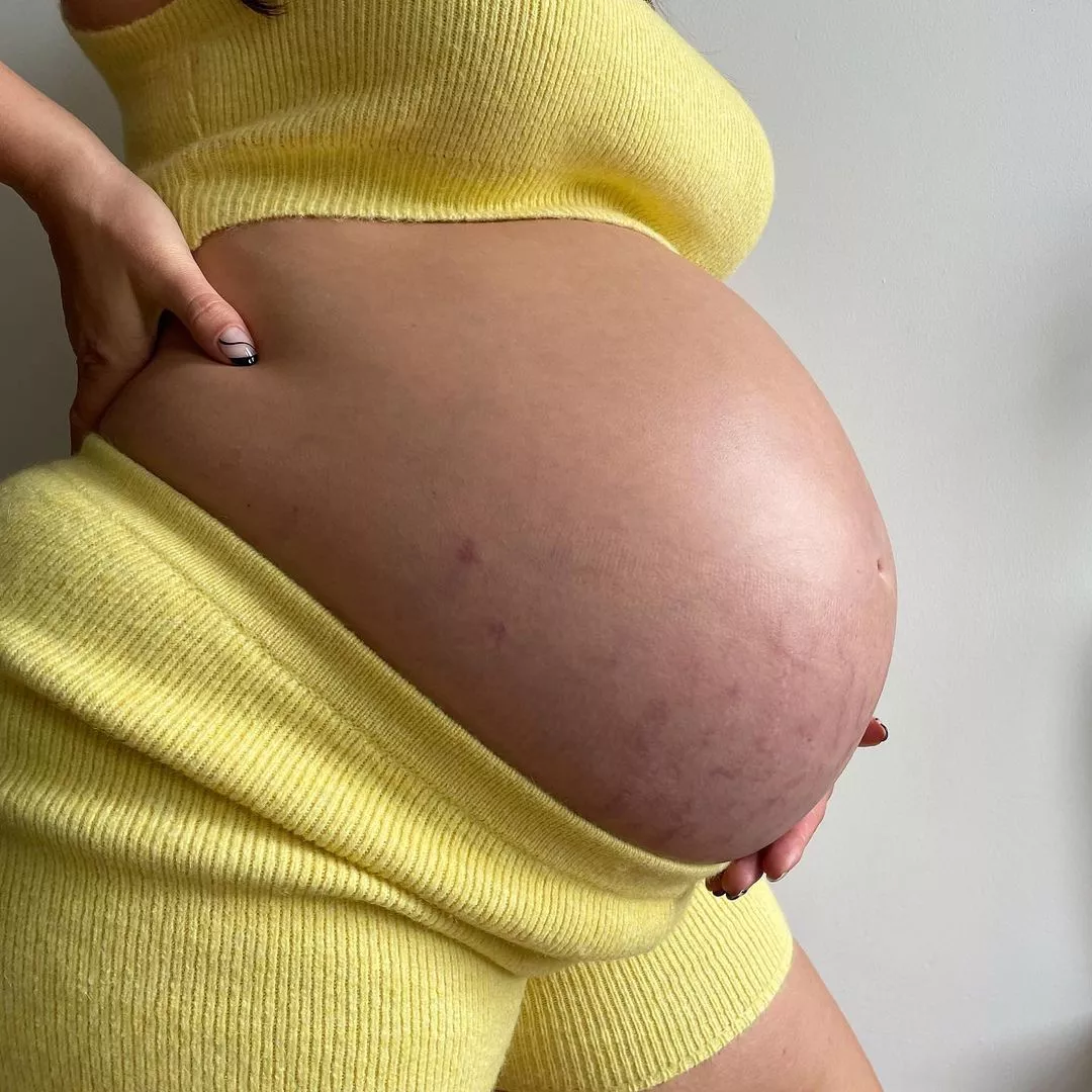 Як виглядає тіло з розтяжками вагітної Ешлі Грем