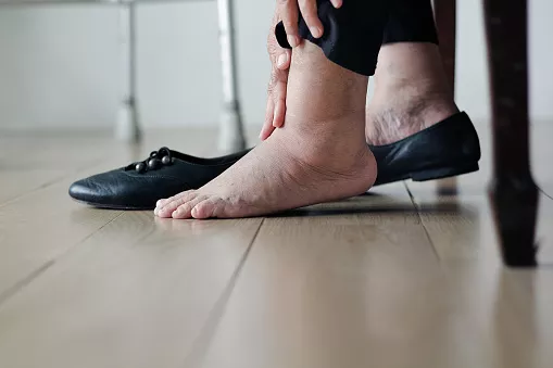 Долгая неподвижность провоцирует отечность ног / Фото: istockphoto