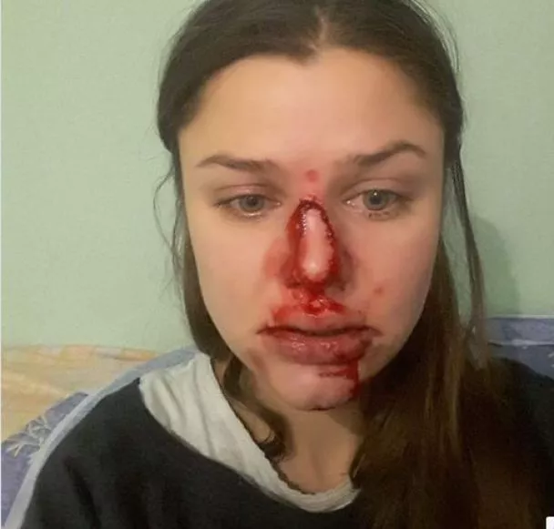 Lilia Shevtsova posted this photo on social media and then deleted the post