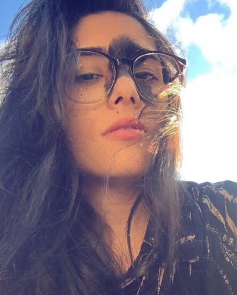 У 24-річної бразилійки Маріан Мендес родима пляма на обличчі. Фото: instagram.com/melzitahh