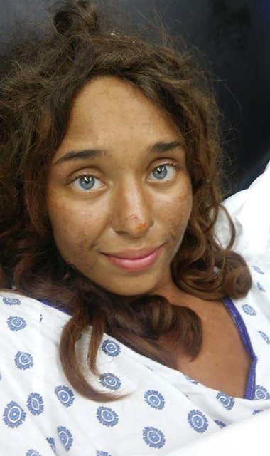 Лиза Терис потерялась в одном из лесов, а нашли ее лишь спустя 28 дней. Фото: thesun.co.uk