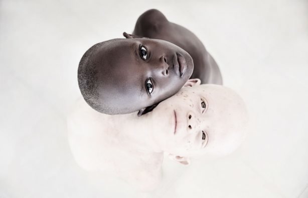 Танзанийцы верят, что альбиносы – проклятие для деревни. Фото: Marinka Masseus /marinkamasseus.com