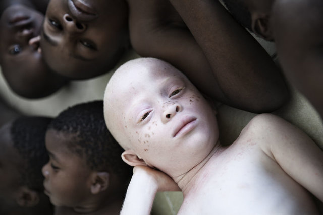 Танзанийцы верят, что альбиносы – проклятие для деревни. Фото: Marinka Masseus /marinkamasseus.com