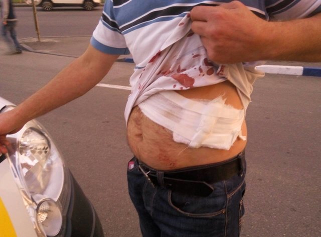 В Киеве неизвестный ранил мужчину ножом, фото Дмитрий
