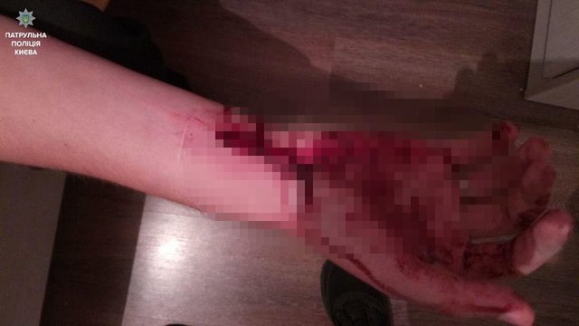 У мужчины была ранена рука. Фото: facebook.com/police.gov.ua