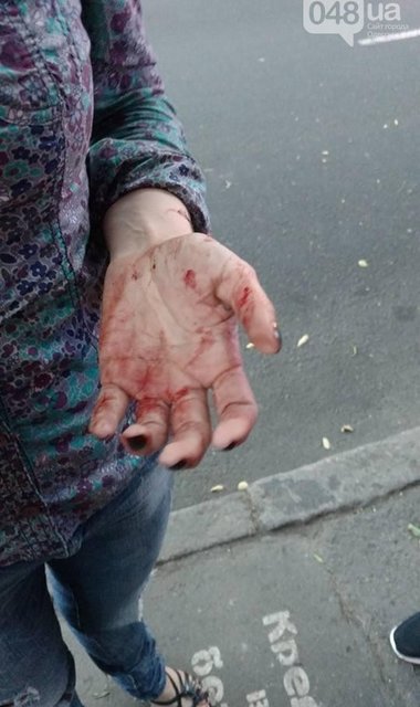 В Одессе избили известную активистку, фото 048.ua