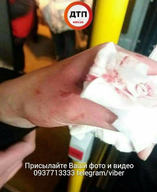 Девушка получила многочисленные травмы. Фото: facebook.com/dtp.kiev.ua