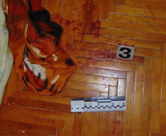 Девушка пырнула парня ножом. Фото: kyiv.npu.gov.ua