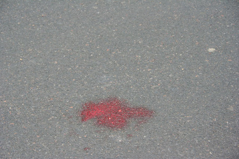 Пешеход отказался от медпомощи, но оставил после себя лужу крови, фото novosti-n.mk.ua