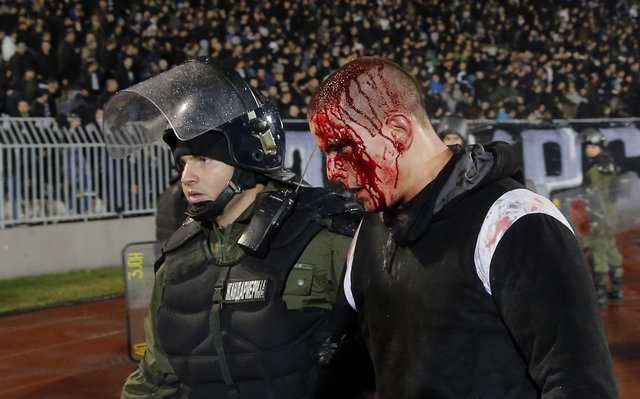 <p>Після бійки ультрас "Партизана" і "Црвена Звєзди". фото AFP</p>