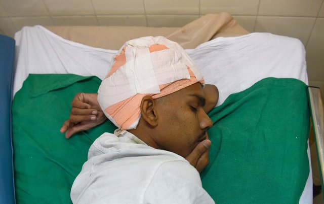 Операция по удалению опухоли мозга. Фото: AFP