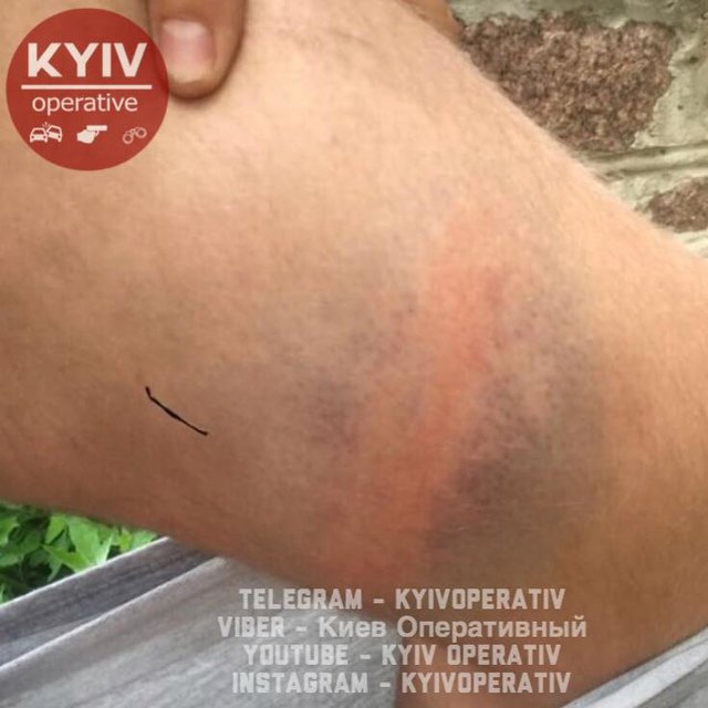 Ромы якобы напали на мужчину. Фото: facebook.com/KyivOperativ