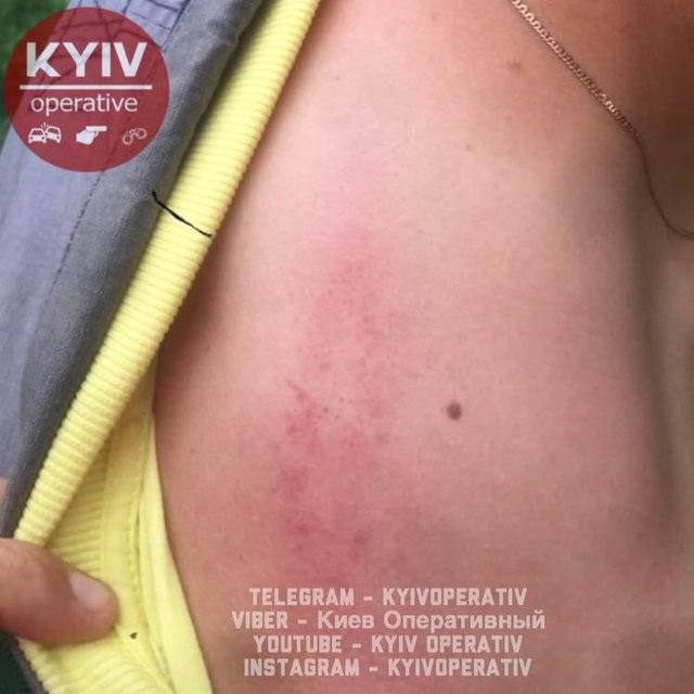 Роми нібито напали на чоловіка. Фото: facebook.com/KyivOperativ