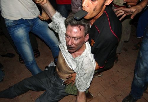 Раненый при нападении на консульство США в Бенгази. Фото AFP