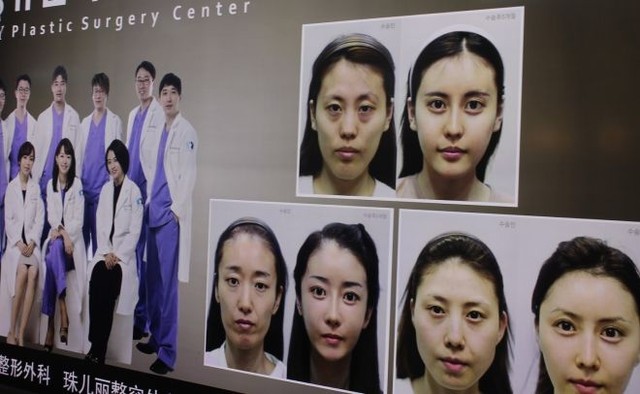 Массовость. Операция по изменению разреза глаз в Южной Корее поставлена на конвейер