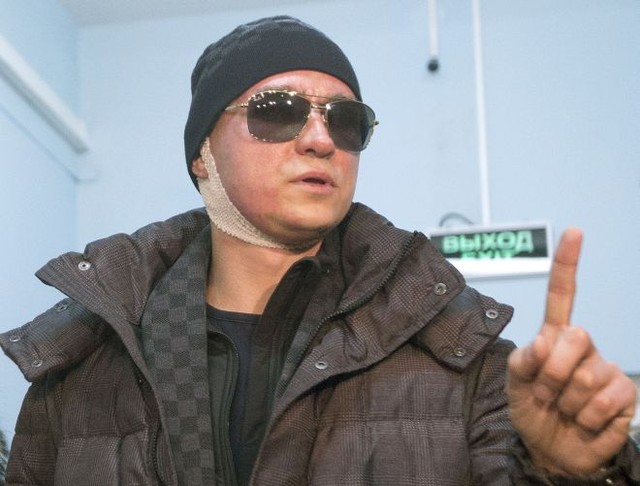 Сергей Филин после нападение. Фото AFP