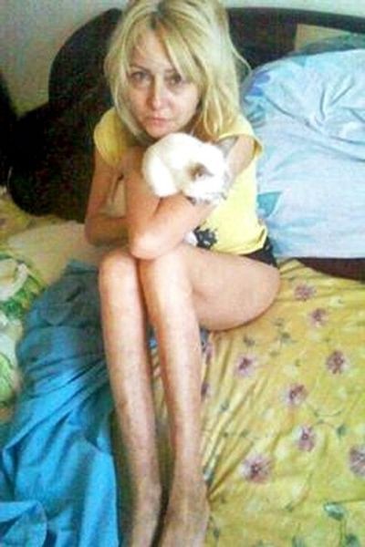 Оксана Хожай во время болезни. Фото с сайта niklife.com.ua