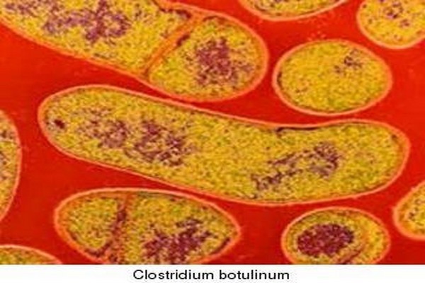 1. Бактерия Clostridium botulinum <br />
Clostridium botulinum  — анаэробная  бактерия рода клостридий, возбудитель ботулизма — тяжелой пищевой интоксикации, вызываемой  токсином и характеризуется поражением нервной системы. Этот смертоносный яд обычно встречается в косметической продукции. Небольшое количество этого яда может убить более 1 миллиарда человек. Среди побочных  эффектов  наблюдаются слабость мышц, нарушение зрения, невнятная речь, сухость во рту и затруднение при глотании. Яд нацелен на дыхательную систему и, в конечном счете, может привести к смерти из-за асфиксии.<br />

