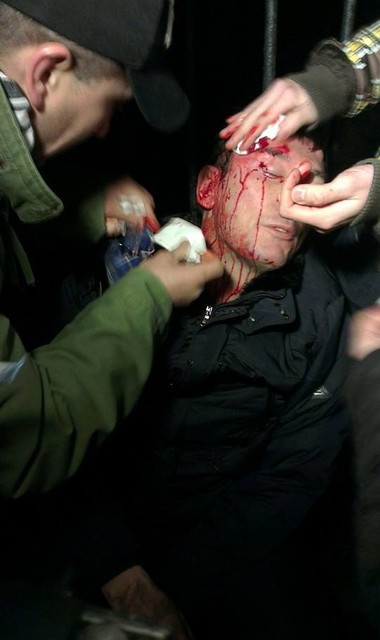 Юрию Луценко пытаются остановить кровотечение. Фото: группа EuroMaydan "Фейсбук"