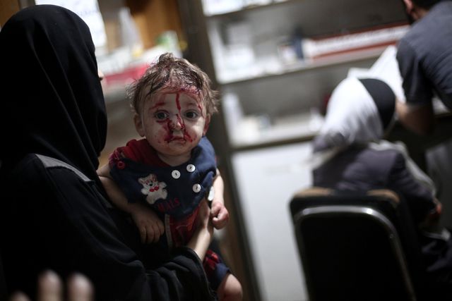 Сирія. 32 людини загинули в результаті серії авіаударів, нанесених урядовими військами відразу за двома населеним пунктам, розташованим в околицях Дамаска: Думі і Кфар Батні. Частина загиблих – мирні жителі. Фото: AFP