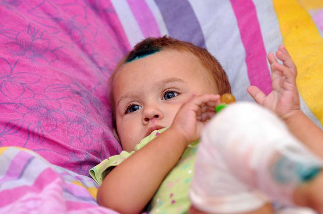 Малышка стойко переносит боль. Фото: fdu.org.ua