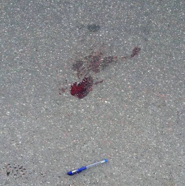 Водитель сбил подростка на переходе. Фото: УГАИ в Киеве